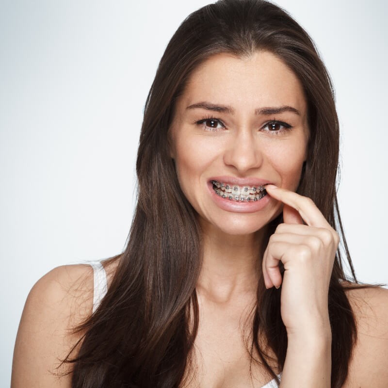 Woman with braces